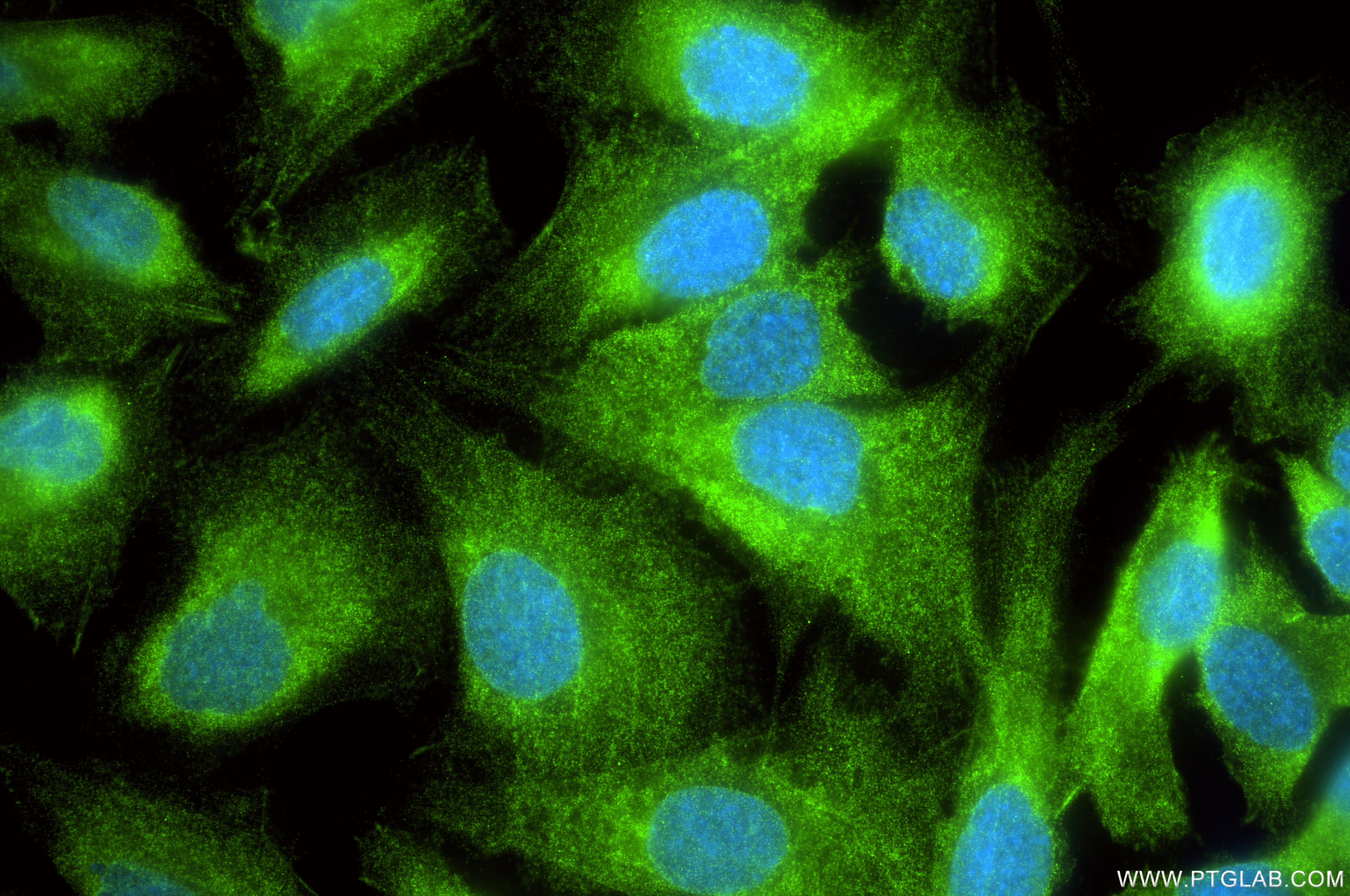Immunofluorescence (IF) / fluorescent staining of SKOV-3 cells using PDLIM7 Recombinant antibody (86283-1-RR)