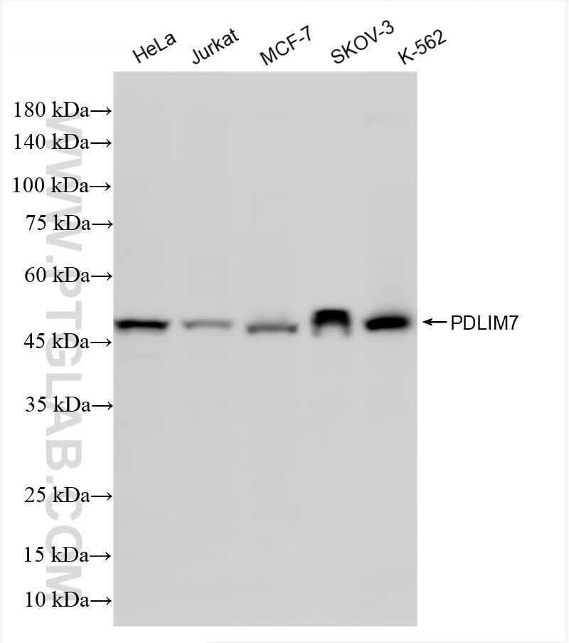 Western Blot (WB) analysis of various lysates using PDLIM7 Recombinant antibody (86283-1-RR)