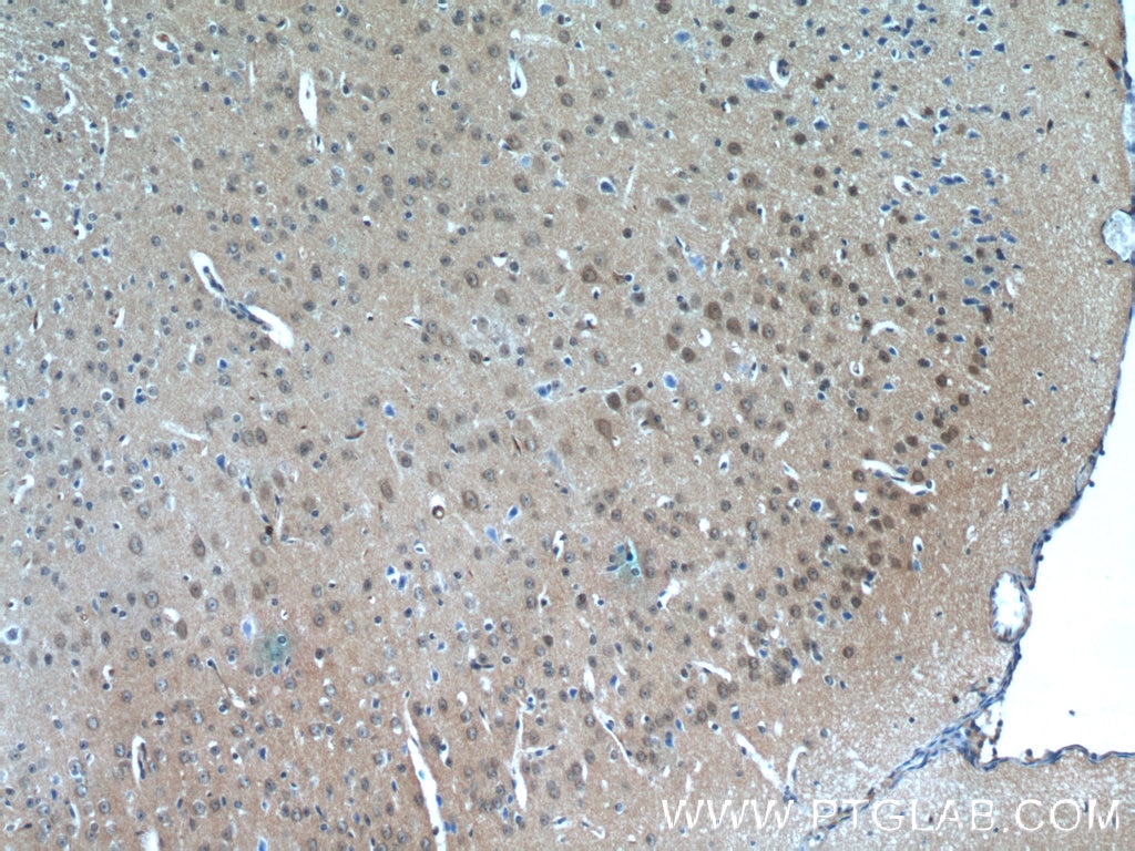 Immunohistochemistry (IHC) staining of mouse brain tissue using PDP2 Polyclonal antibody (13404-1-AP)