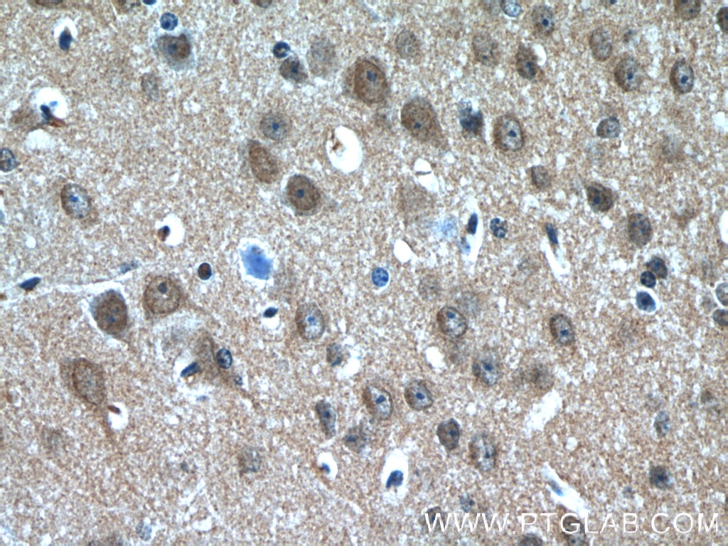 Immunohistochemistry (IHC) staining of mouse brain tissue using PDP2 Polyclonal antibody (13404-1-AP)