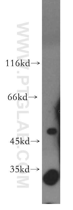 Western Blot (WB) analysis of HeLa cells using PDP2 Polyclonal antibody (13404-1-AP)