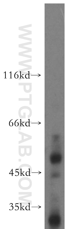Western Blot (WB) analysis of mouse kidney tissue using PDP2 Polyclonal antibody (13404-1-AP)