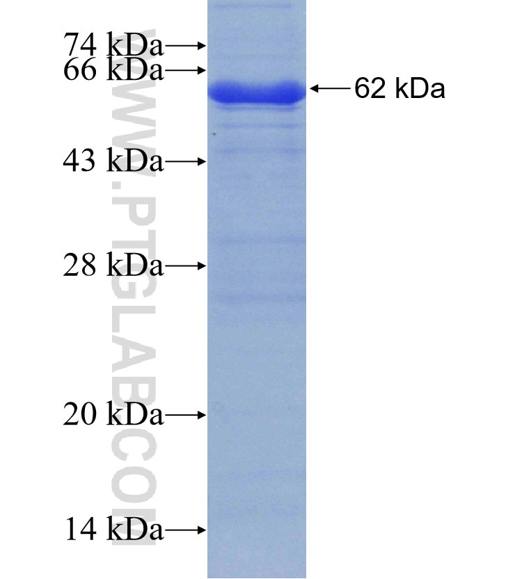 PDP2 fusion protein Ag4257 SDS-PAGE
