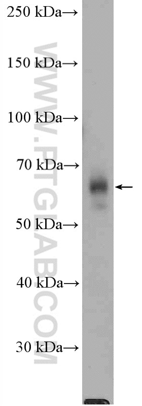 Western Blot (WB) analysis of LNCaP cells using PDPK1 Polyclonal antibody (17086-1-AP)