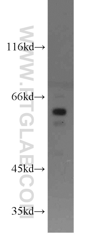 Western Blot (WB) analysis of MCF-7 cells using PDPK1 Polyclonal antibody (17086-1-AP)