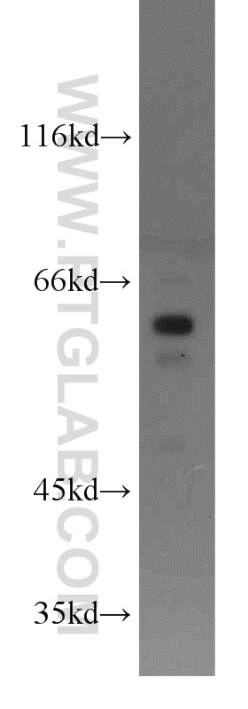 WB analysis of MCF-7 using 17086-1-AP