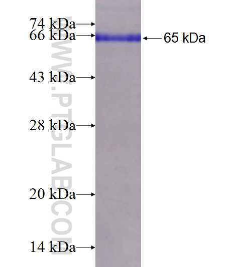 PDPK1 fusion protein Ag9213 SDS-PAGE