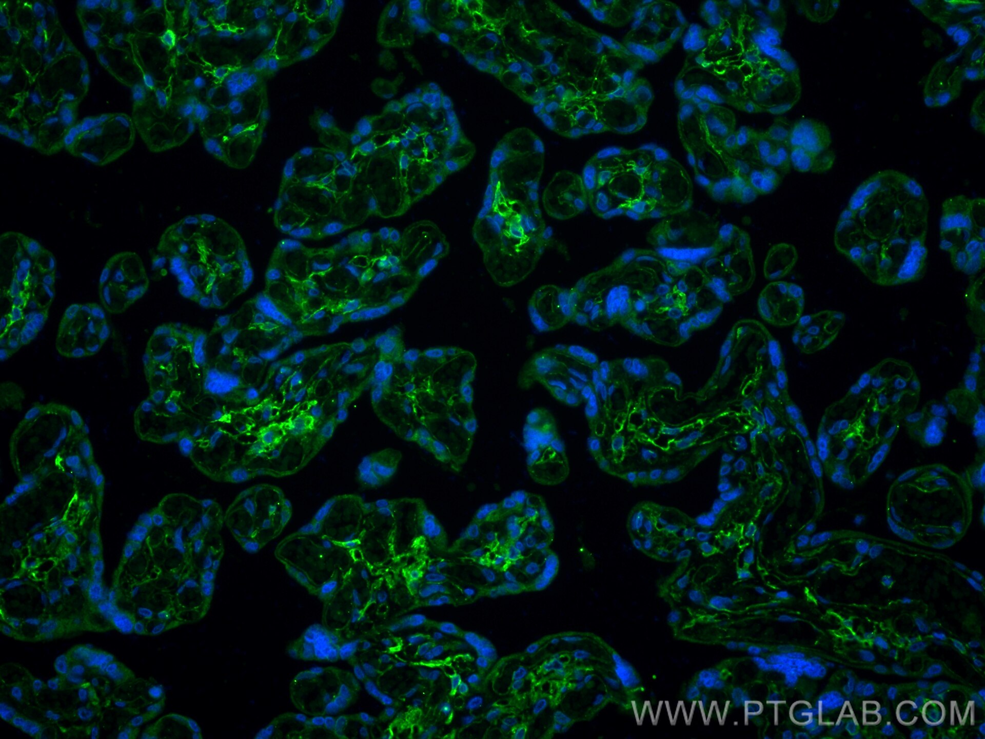 Immunofluorescence (IF) / fluorescent staining of human placenta tissue using Podoplanin Polyclonal antibody (11629-1-AP)
