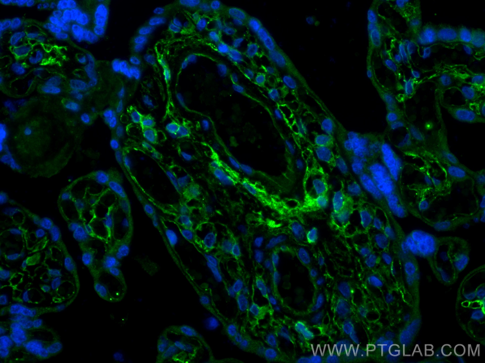 Immunofluorescence (IF) / fluorescent staining of human placenta tissue using Podoplanin Polyclonal antibody (11629-1-AP)