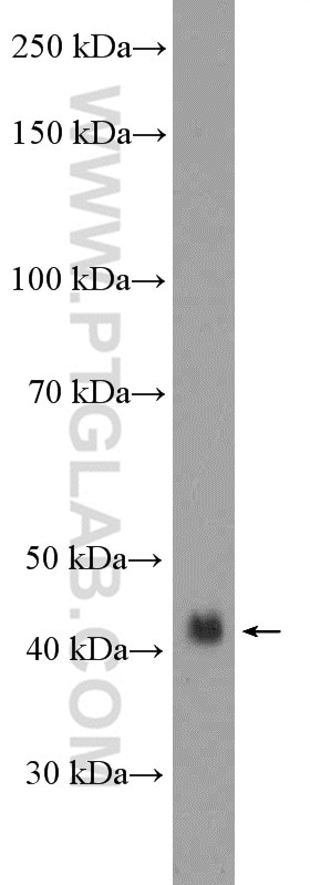 Western Blot (WB) analysis of HEK-293 cells using Podoplanin Polyclonal antibody (11629-1-AP)