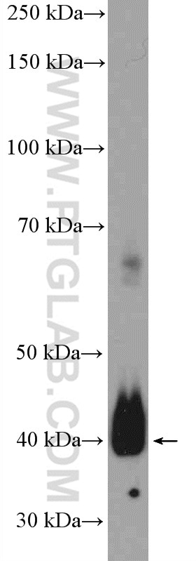 Western Blot (WB) analysis of human placenta tissue using Podoplanin Polyclonal antibody (11629-1-AP)