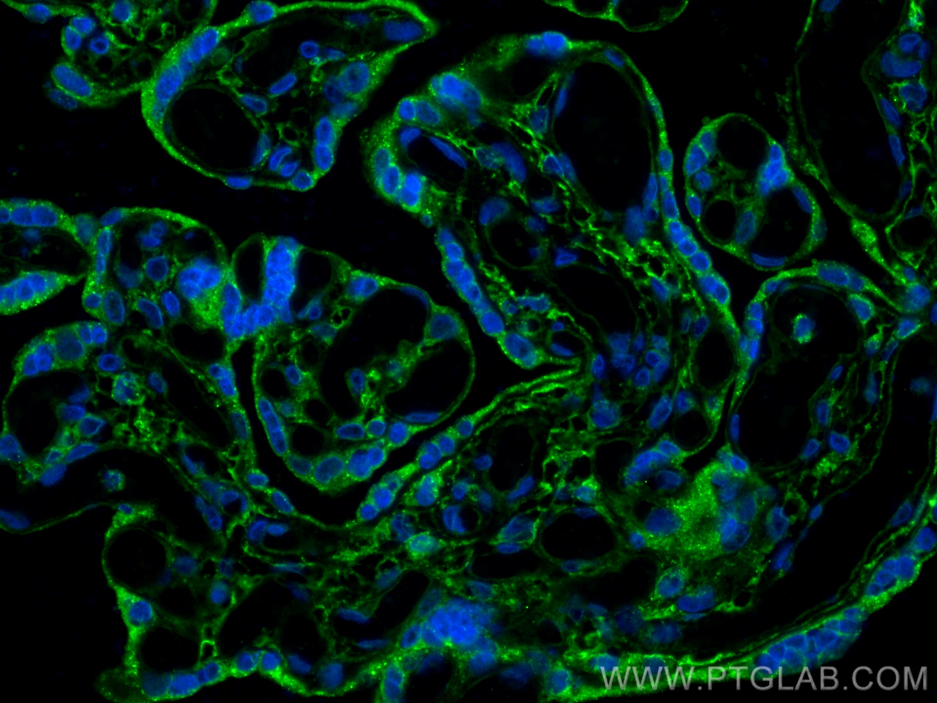 Immunofluorescence (IF) / fluorescent staining of human placenta tissue using Podoplanin Polyclonal antibody (22099-1-AP)