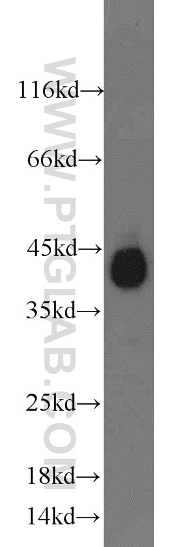 Western Blot (WB) analysis of human brain tissue using Podoplanin Polyclonal antibody (22099-1-AP)