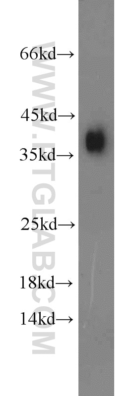 Western Blot (WB) analysis of human placenta tissue using Podoplanin Polyclonal antibody (22099-1-AP)