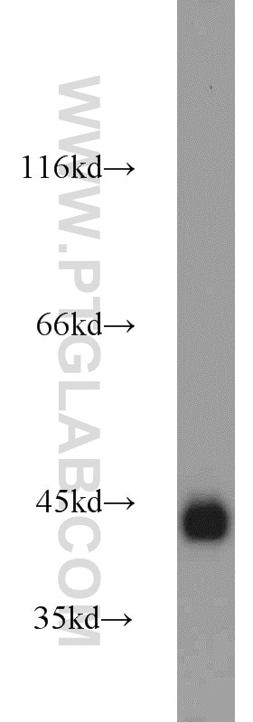 Western Blot (WB) analysis of human brain tissue using Podoplanin Polyclonal antibody (22099-1-AP)