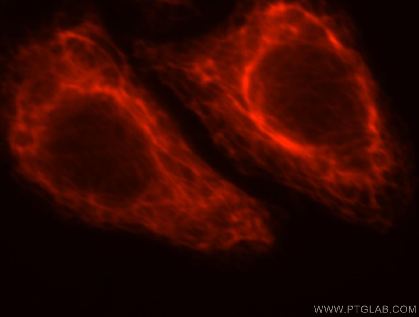Immunofluorescence (IF) / fluorescent staining of HepG2 cells using PDRG1 Polyclonal antibody (16968-1-AP)