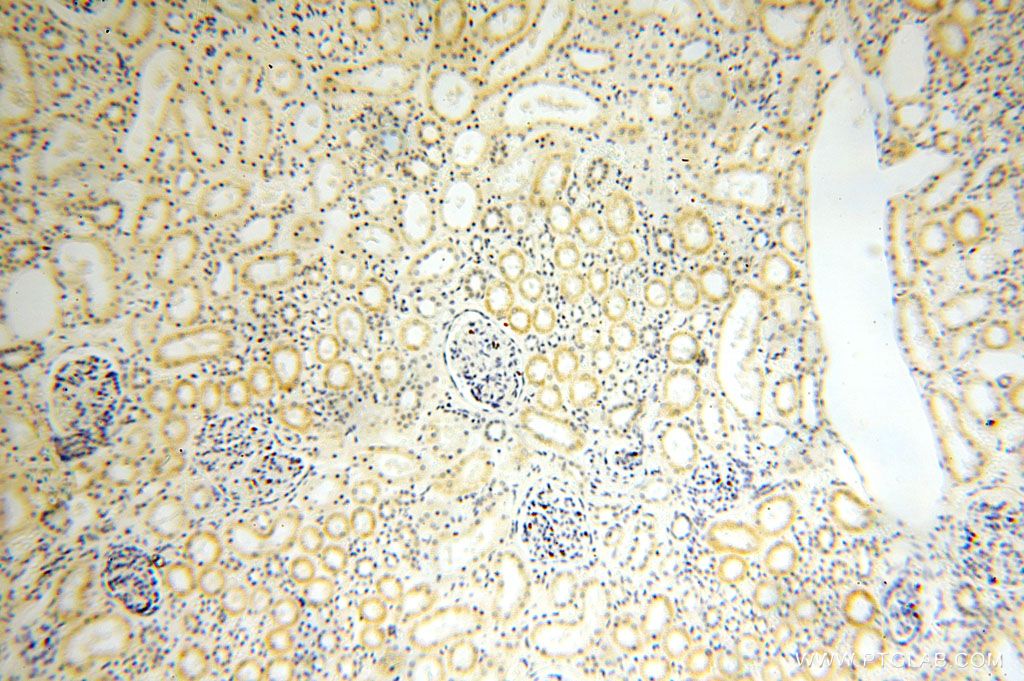Immunohistochemistry (IHC) staining of human kidney tissue using PDRG1 Polyclonal antibody (16968-1-AP)