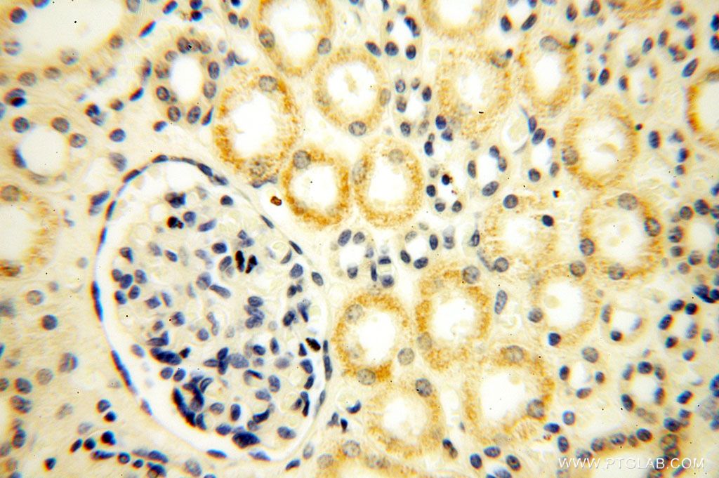 Immunohistochemistry (IHC) staining of human kidney tissue using PDRG1 Polyclonal antibody (16968-1-AP)