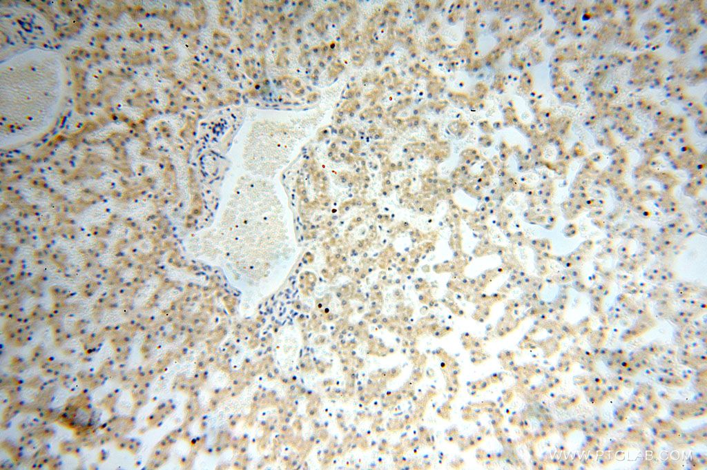 Immunohistochemistry (IHC) staining of human liver tissue using PDRG1 Polyclonal antibody (16968-1-AP)