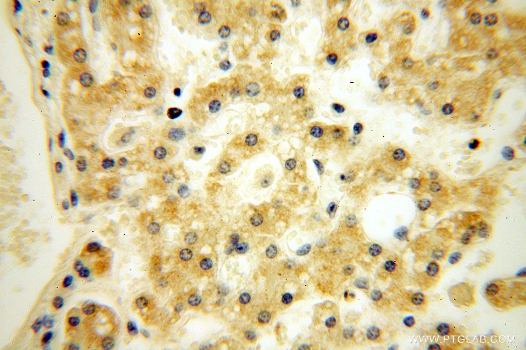 Immunohistochemistry (IHC) staining of human liver tissue using PDRG1 Polyclonal antibody (16968-1-AP)