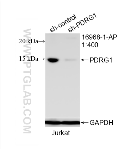 Western Blot (WB) analysis of Jurkat cells using PDRG1 Polyclonal antibody (16968-1-AP)