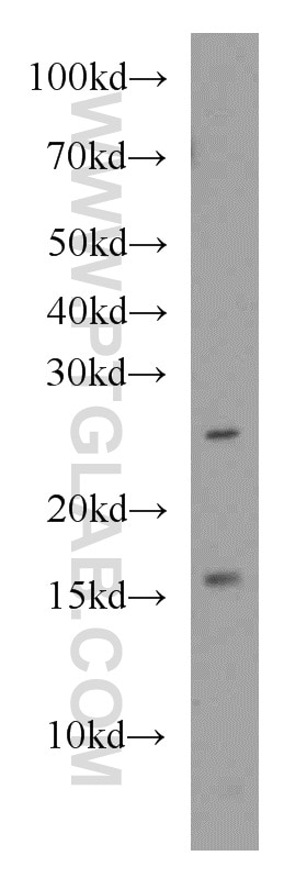 Western Blot (WB) analysis of Jurkat cells using PDRG1 Polyclonal antibody (16968-1-AP)