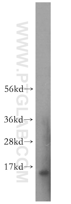 Western Blot (WB) analysis of Jurkat cells using PDRG1 Polyclonal antibody (16968-1-AP)