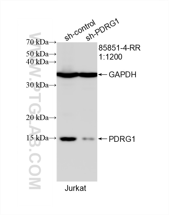 Western Blot (WB) analysis of Jurkat cells using PDRG1 Recombinant antibody (85851-4-RR)