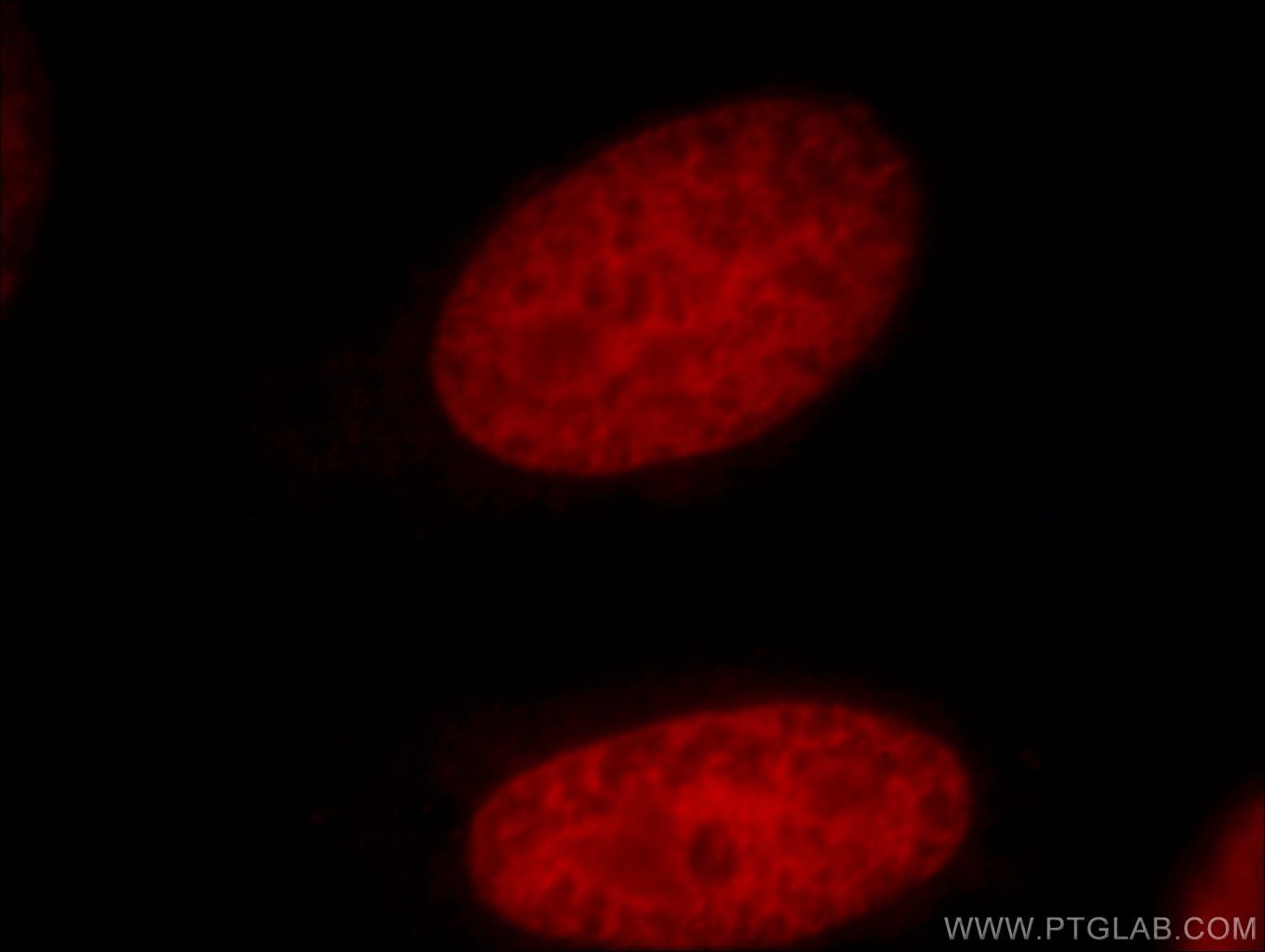 Immunofluorescence (IF) / fluorescent staining of HepG2 cells using PDS5A Polyclonal antibody (17485-1-AP)
