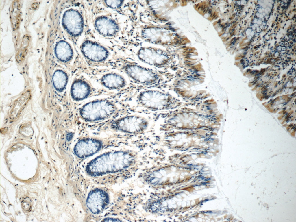 Immunohistochemistry (IHC) staining of human colon tissue using PDS5A Polyclonal antibody (17485-1-AP)