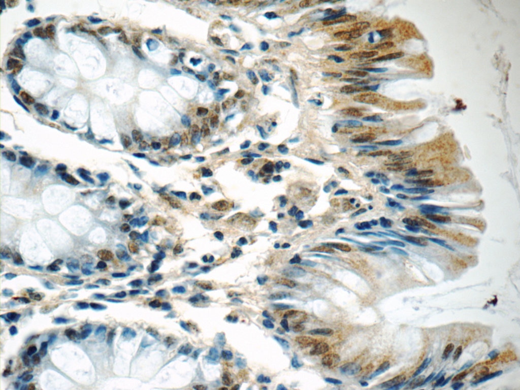 Immunohistochemistry (IHC) staining of human colon tissue using PDS5A Polyclonal antibody (17485-1-AP)