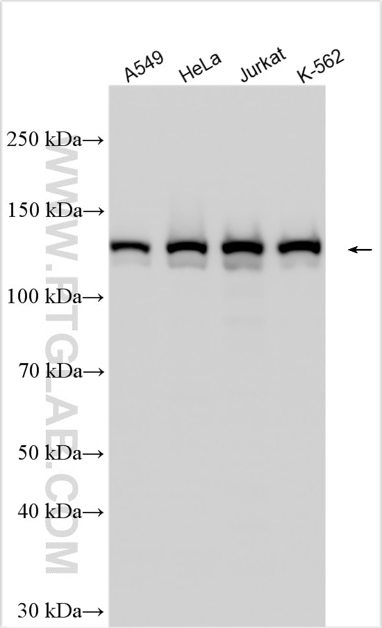 Western Blot (WB) analysis of various lysates using PDS5A Polyclonal antibody (17485-1-AP)
