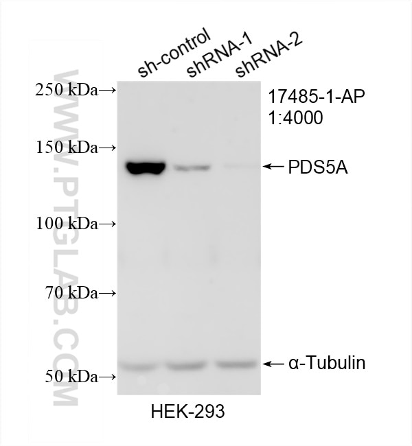 Western Blot (WB) analysis of HEK-293 cells using PDS5A Polyclonal antibody (17485-1-AP)