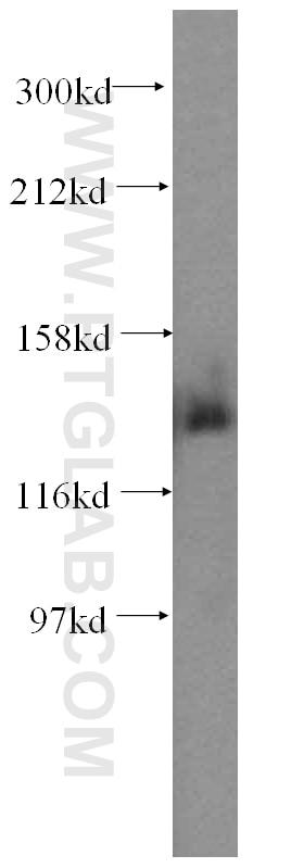 Western Blot (WB) analysis of HEK-293 cells using PDS5A Polyclonal antibody (17485-1-AP)