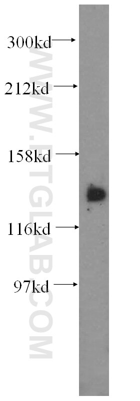 Western Blot (WB) analysis of mouse kidney tissue using PDS5A Polyclonal antibody (17485-1-AP)