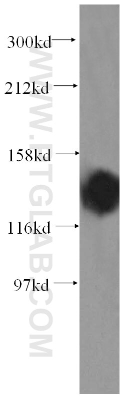 Western Blot (WB) analysis of COLO 320 cells using PDS5A Polyclonal antibody (17485-1-AP)