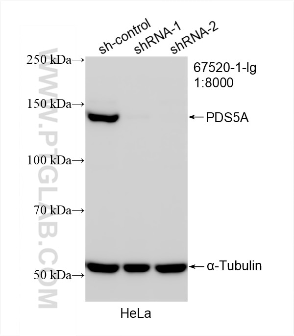 Western Blot (WB) analysis of HeLa cells using PDS5A Monoclonal antibody (67520-1-Ig)
