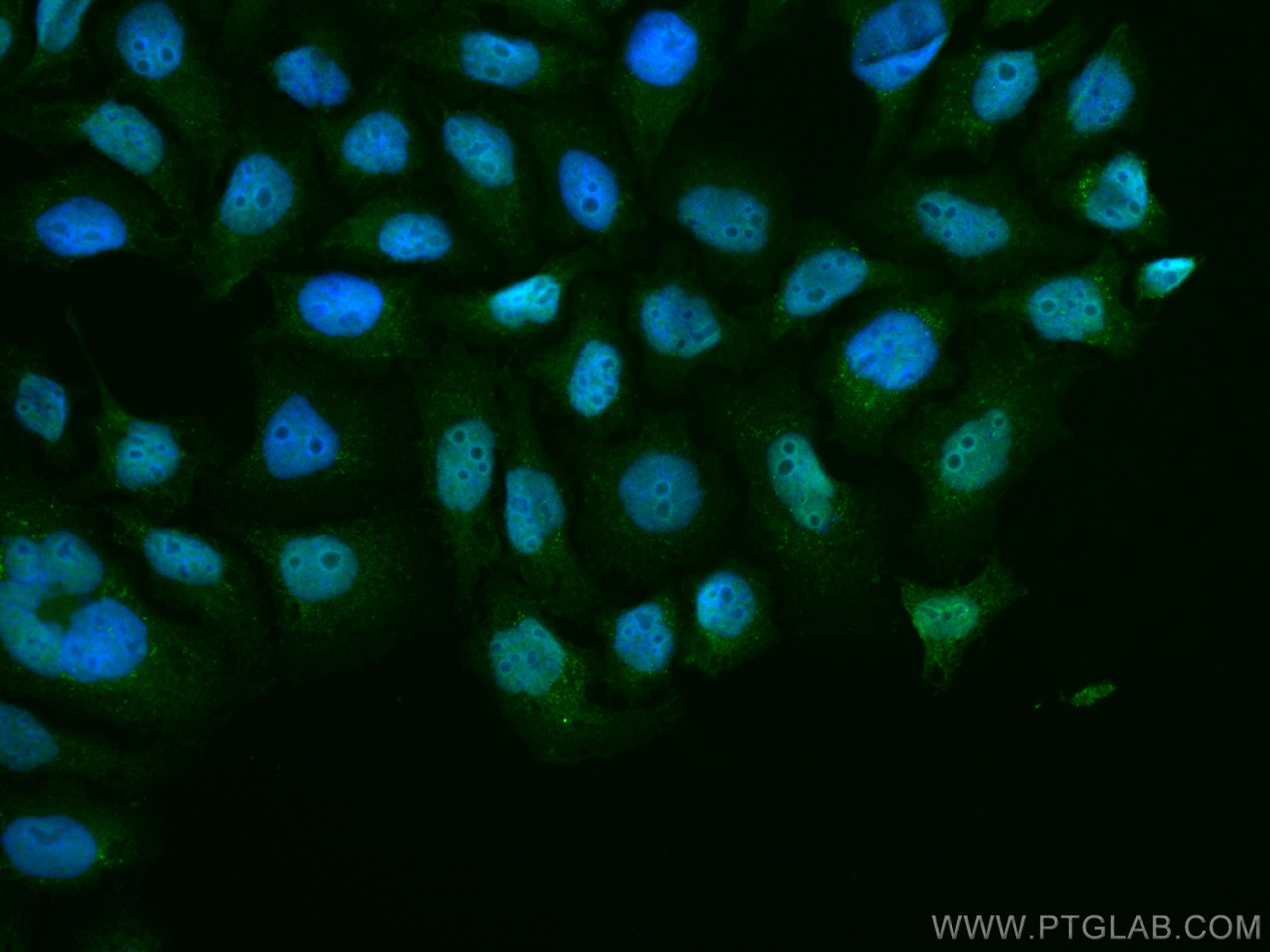Immunofluorescence (IF) / fluorescent staining of SMMC-7721 cells using CoraLite® Plus 488-conjugated PDS5A Monoclonal ant (CL488-67520)