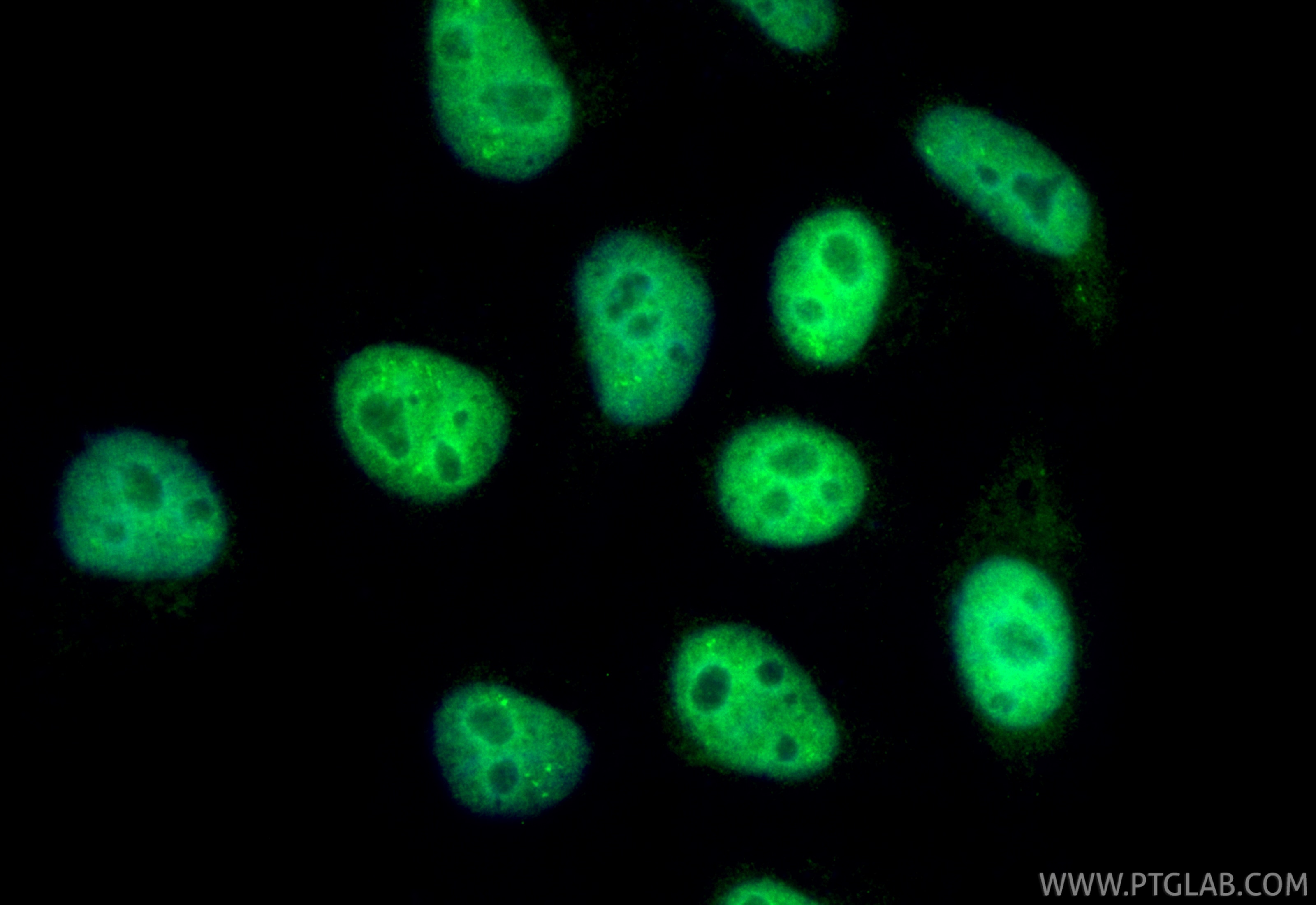 Immunofluorescence (IF) / fluorescent staining of HepG2 cells using CoraLite® Plus 488-conjugated PDS5A Monoclonal ant (CL488-67520)