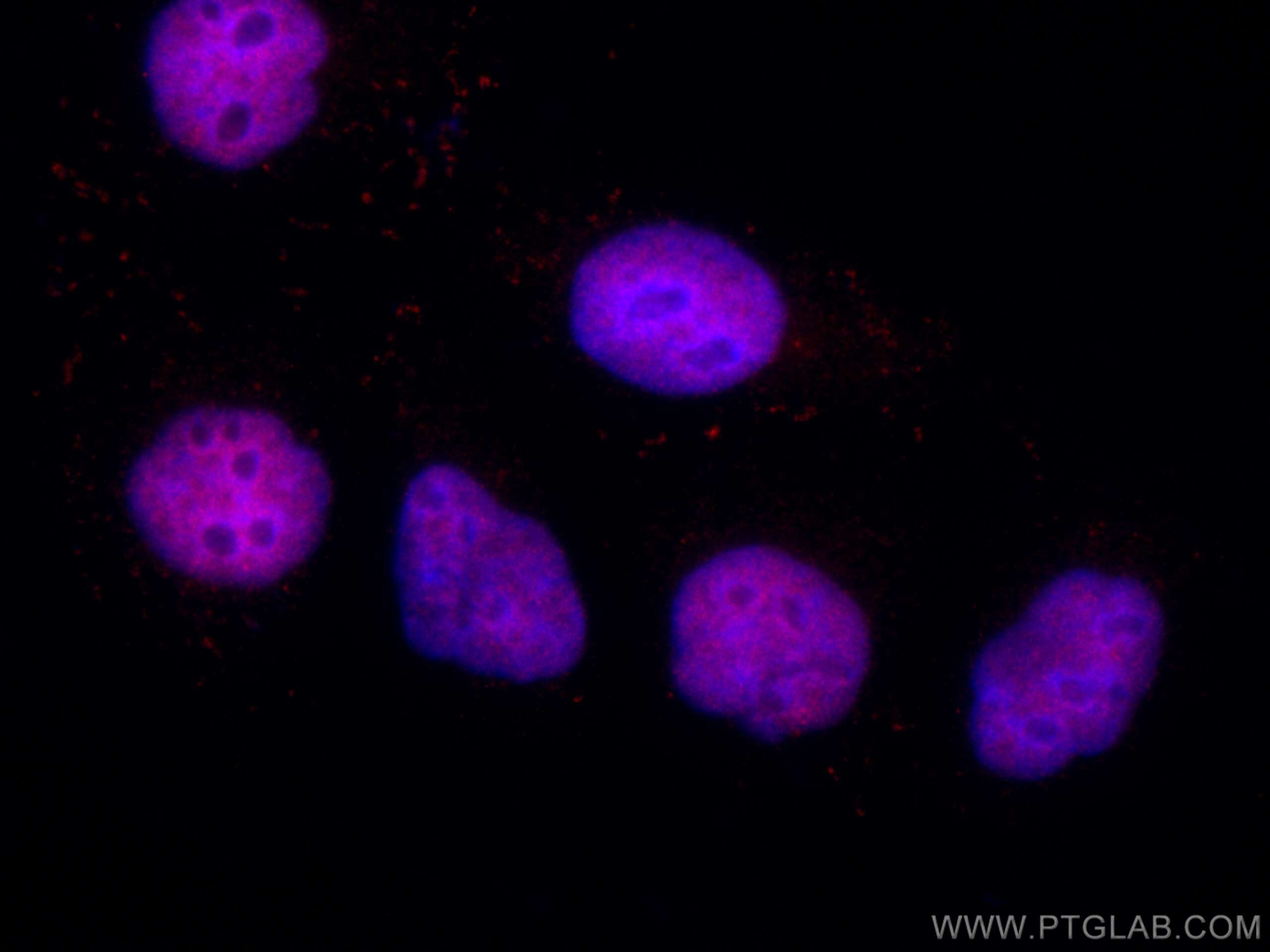 Immunofluorescence (IF) / fluorescent staining of SMMC-7721 cells using CoraLite®594-conjugated PDS5A Monoclonal antibody (CL594-67520)