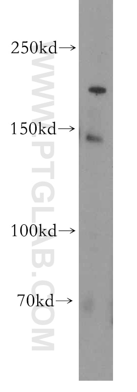 Western Blot (WB) analysis of HT-1080 cells using PDS5B Polyclonal antibody (18796-1-AP)