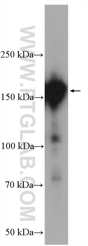 Western Blot (WB) analysis of PC-3 cells using PDS5B Polyclonal antibody (28318-1-AP)