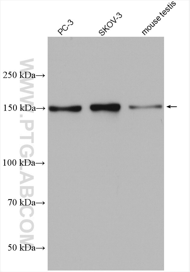 Western Blot (WB) analysis of various lysates using PDS5B Polyclonal antibody (28318-1-AP)