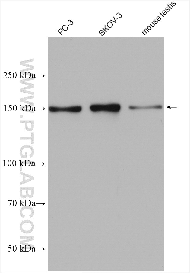 Western Blot (WB) analysis of various lysates using PDS5B Polyclonal antibody (28318-1-AP)