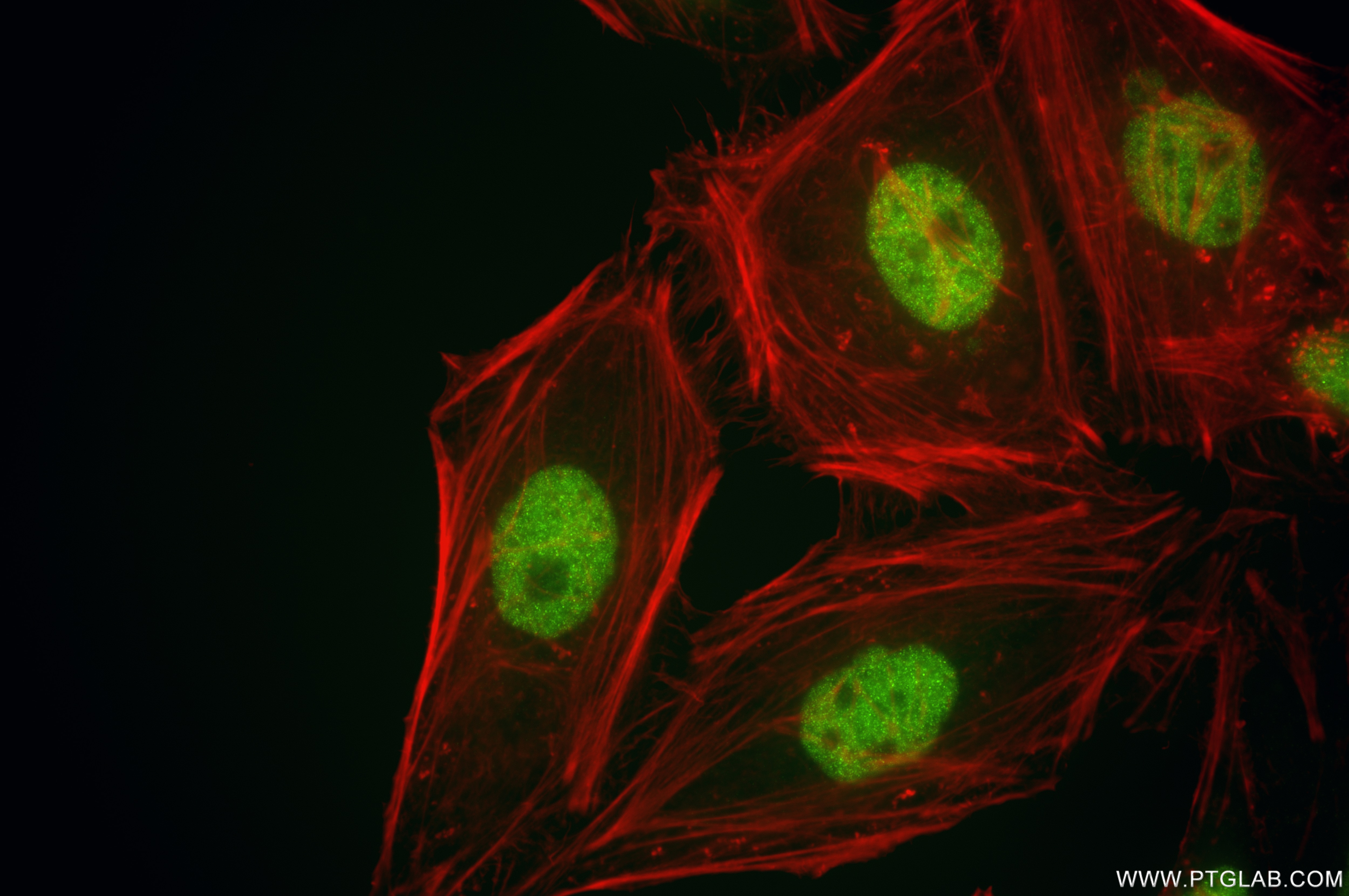 Immunofluorescence (IF) / fluorescent staining of HeLa cells using PDS5B Recombinant antibody (86088-2-RR)