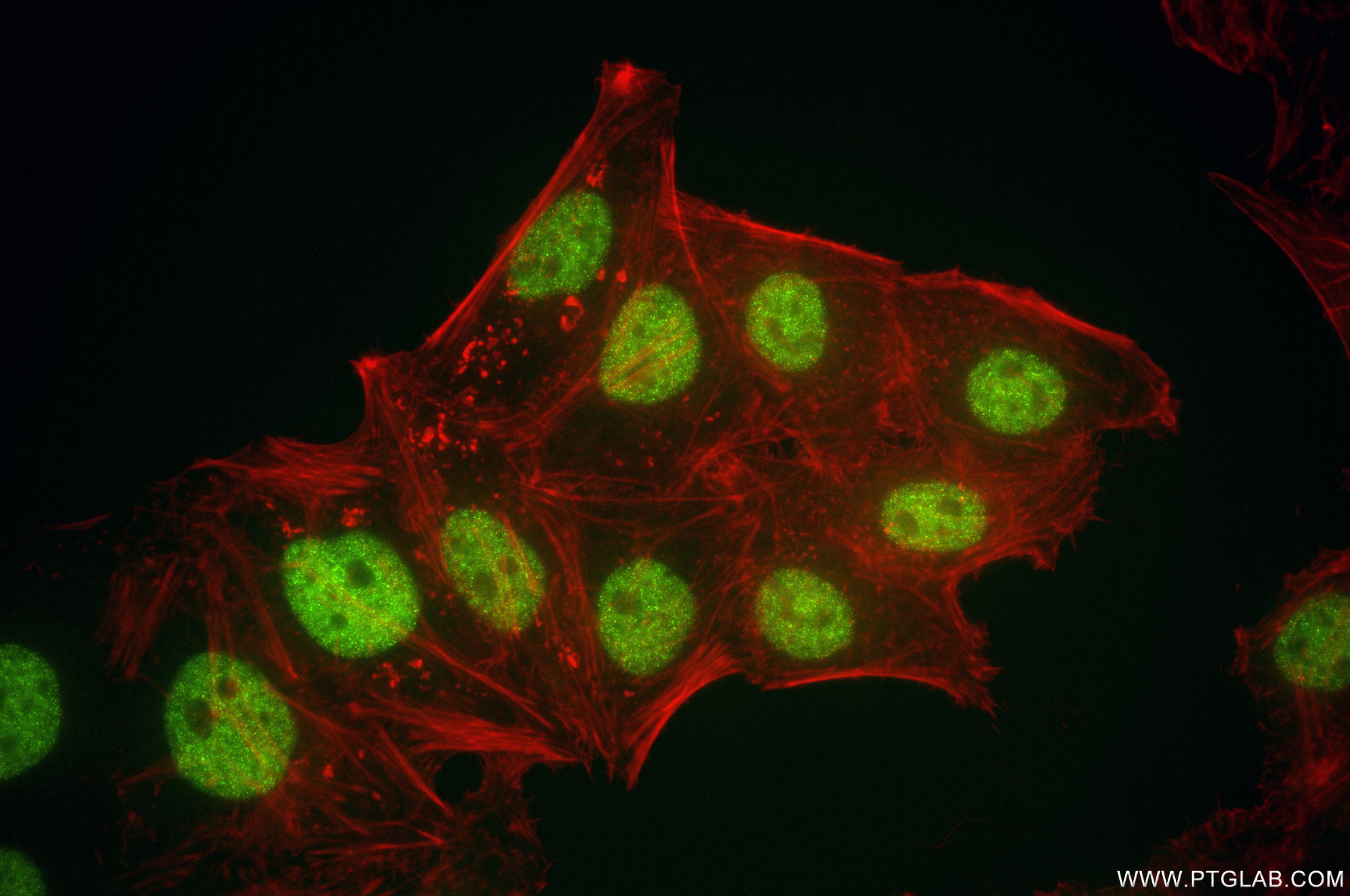 Immunofluorescence (IF) / fluorescent staining of HepG2 cells using PDS5B Recombinant antibody (86088-2-RR)