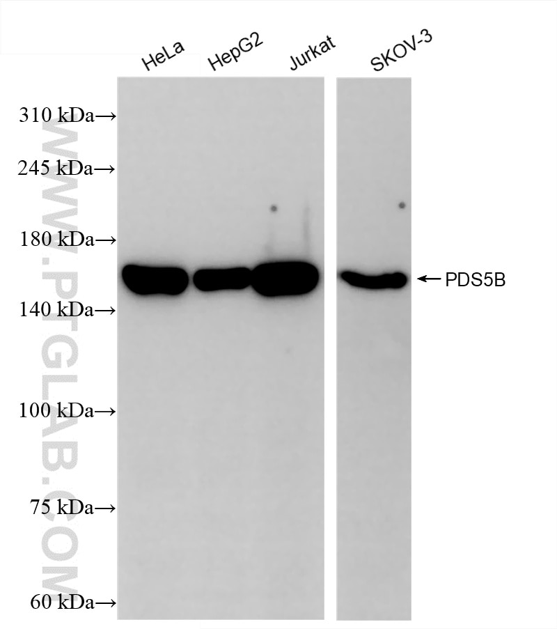 Western Blot (WB) analysis of various lysates using PDS5B Recombinant antibody (86088-2-RR)