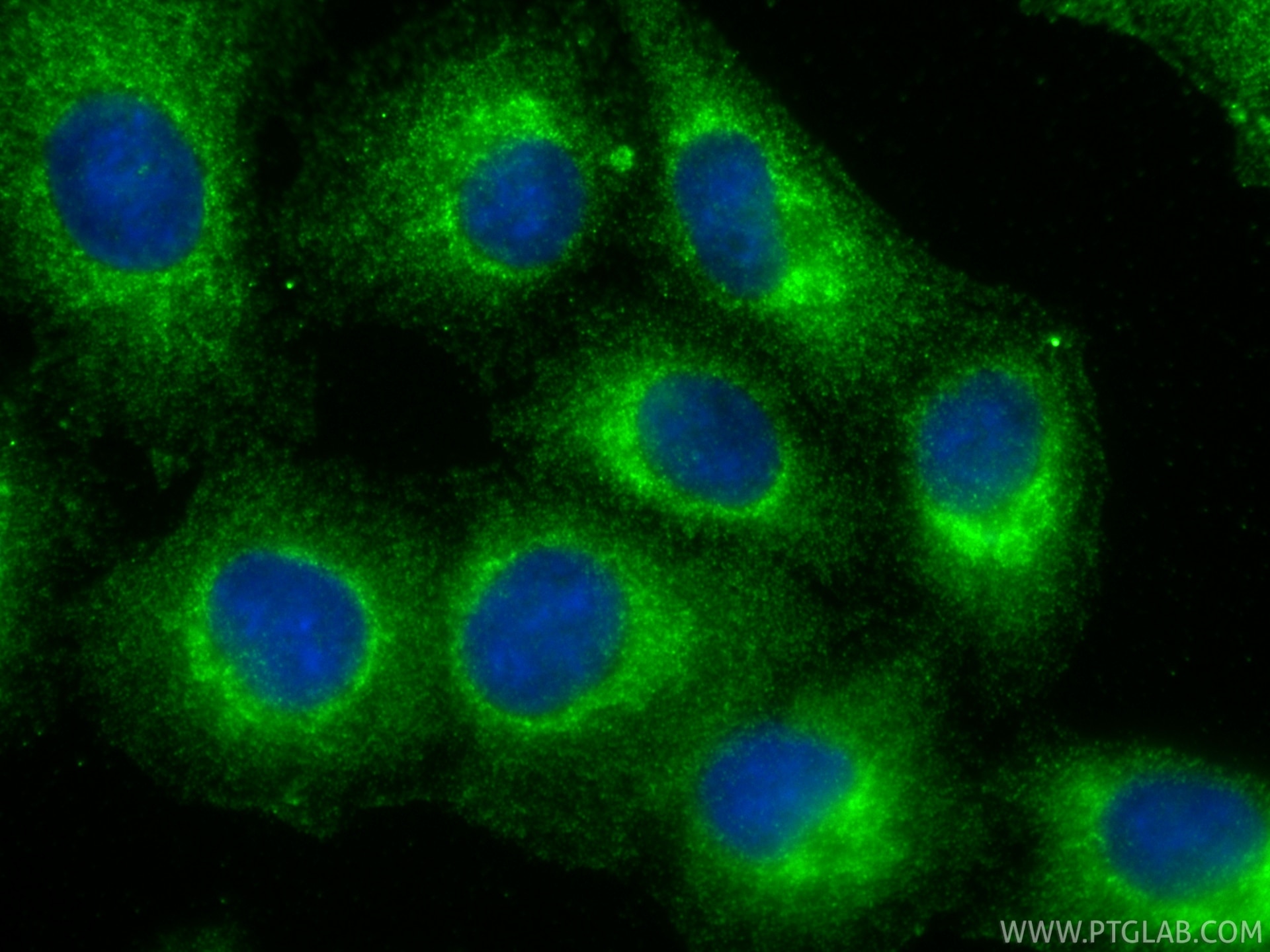 IF Staining of A549 using 33109-1-AP (same clone as 33109-1-PBS) Immunofluorescence (IF) / fluorescent staining of A549 cells using PDSS1 Polyclonal antibody (33109-1-AP)