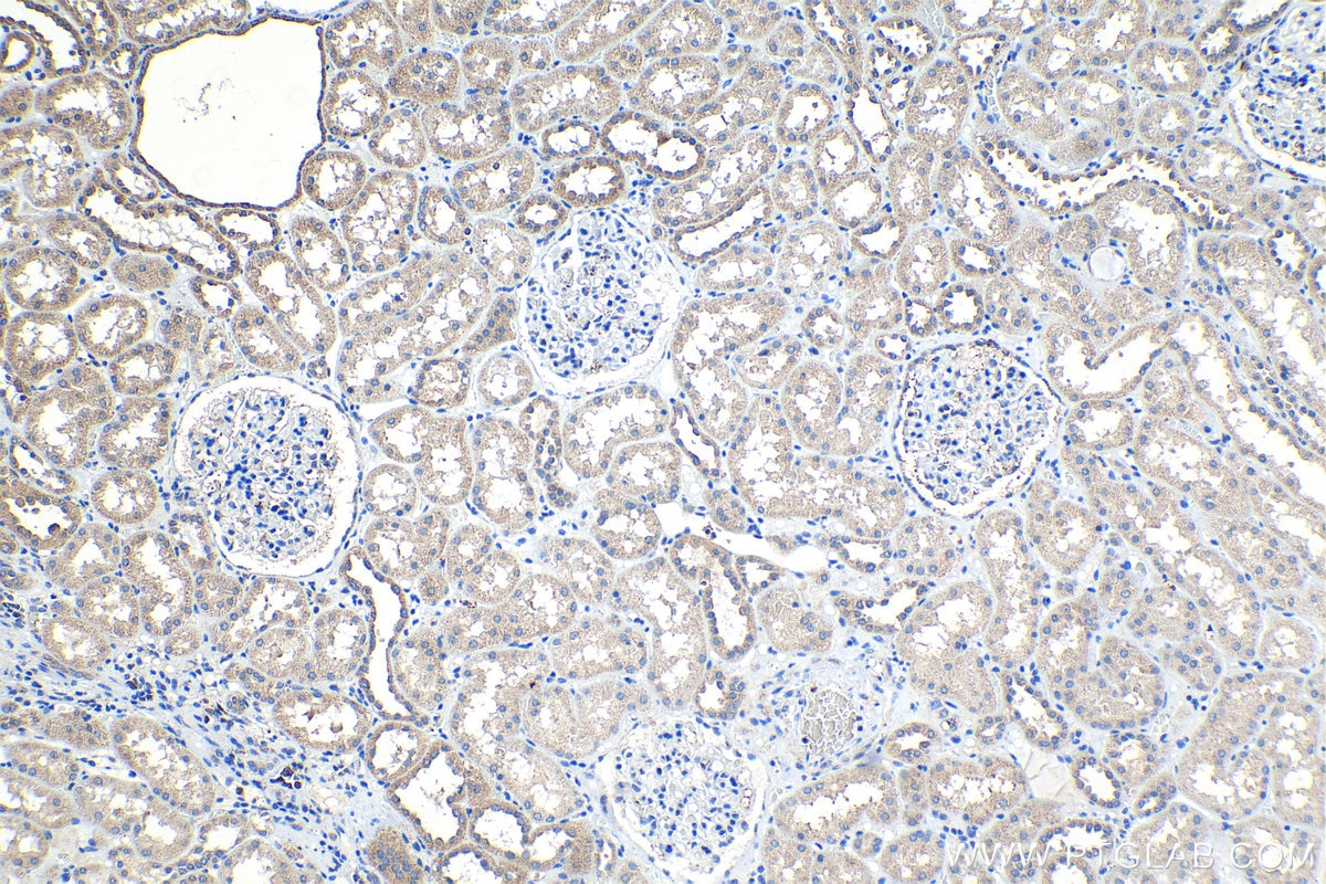 Immunohistochemistry (IHC) staining of human kidney tissue using PDSS2 Polyclonal antibody (13544-1-AP)