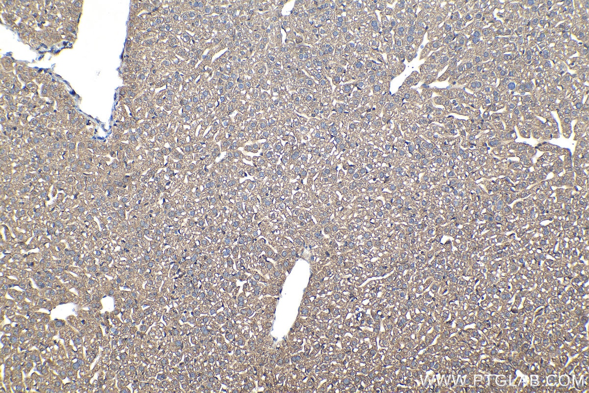 Immunohistochemistry (IHC) staining of mouse liver tissue using PDSS2 Polyclonal antibody (13544-1-AP)